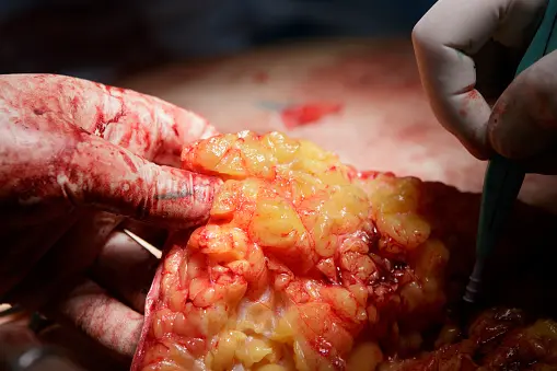 Quiet office with acoustic ceiling panels